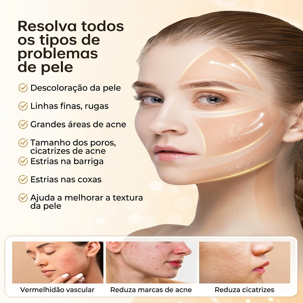 Cartucho de agulha descartavel Hidrapen